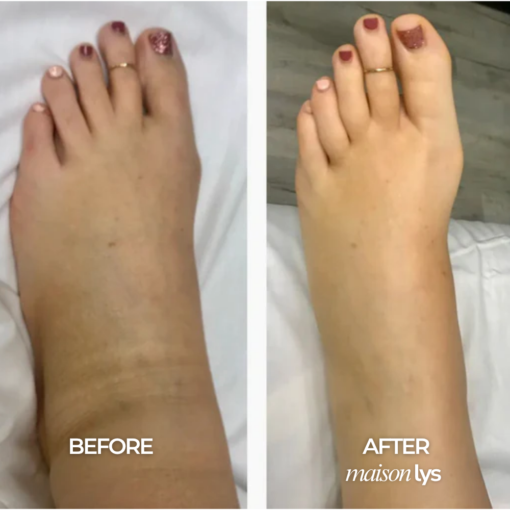 Before and after